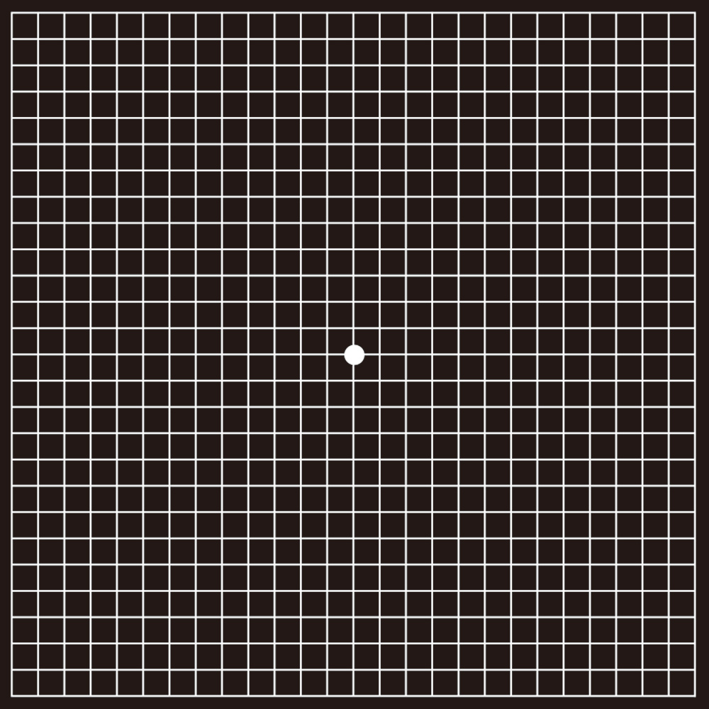 加齢黄斑変性症のチェックシート